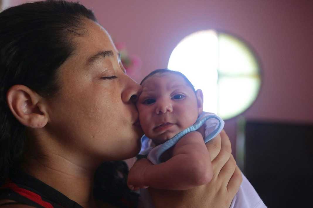 Niños con microcefalia