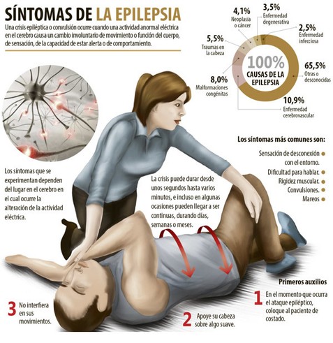 EPILEPSIA
