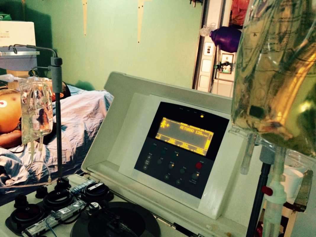 Guillain-Barré en el Hospital Escuela