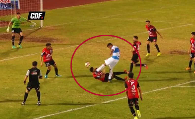 De una patada le fracturan la cara a futbolista en Chile