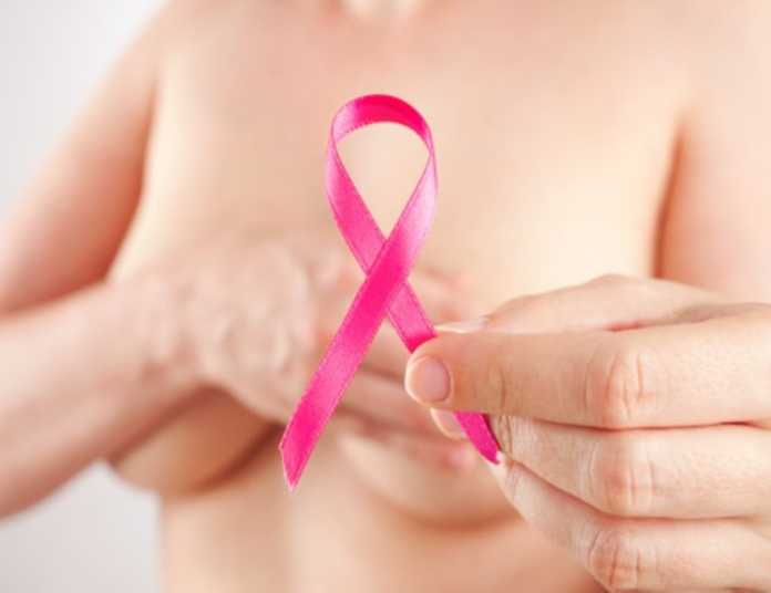 El cáncer de mama