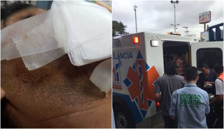 heridos por explosión de un mortero en Comayagüela