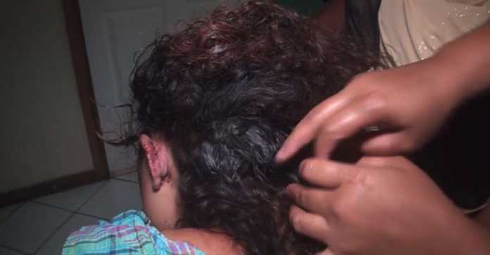Mujer golpeada en Olanchito Mujer golpeada en Olanchito