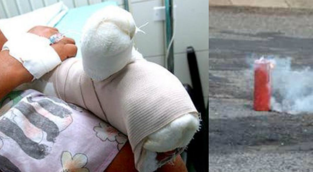 niño en Atlántida