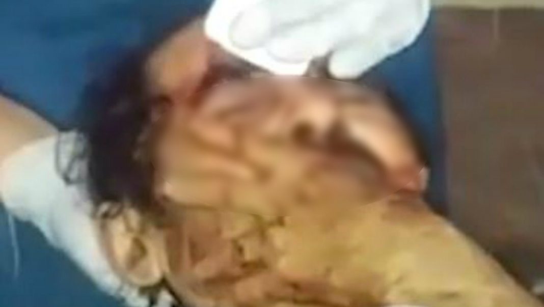 pelea a machetazos por mujer en Copán