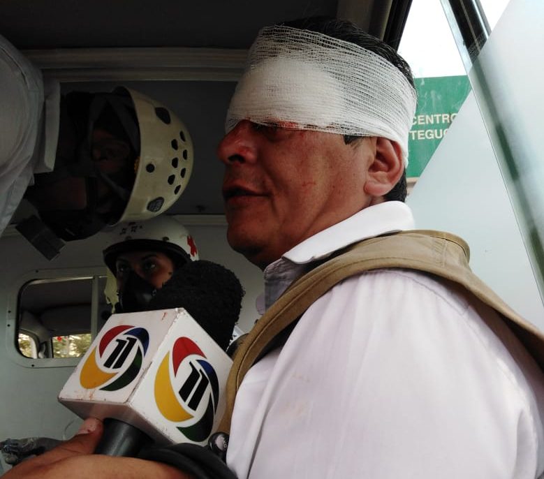 periodista de canal 11