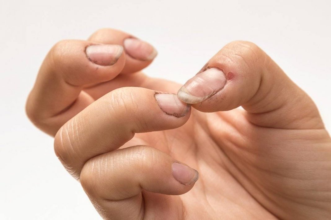 uñas