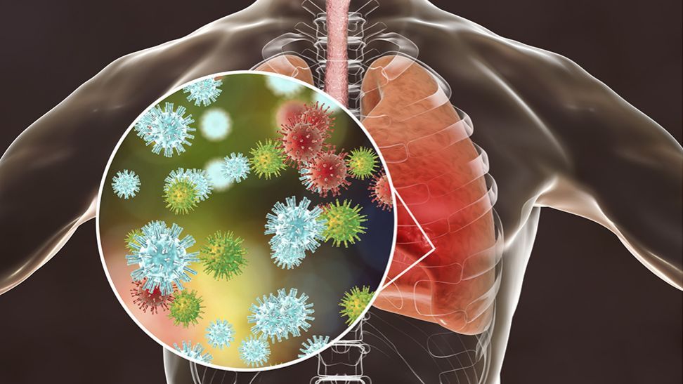 coronavirus