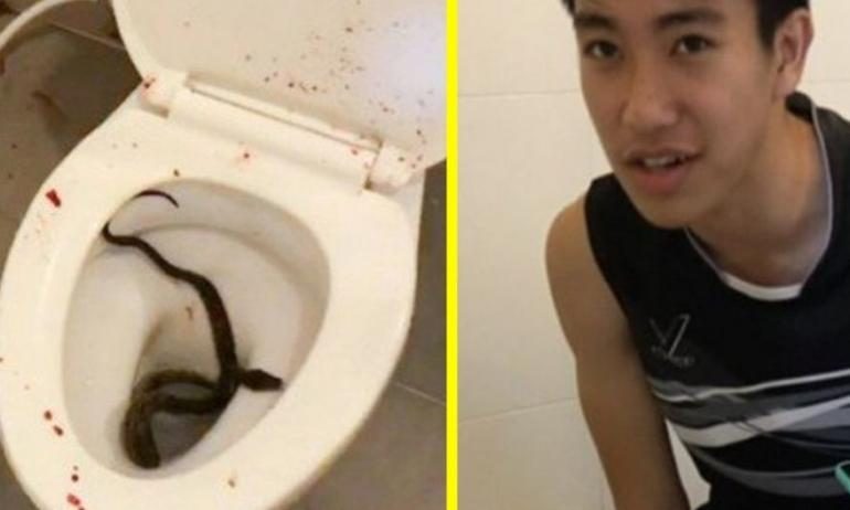 joven mordido por serpiente