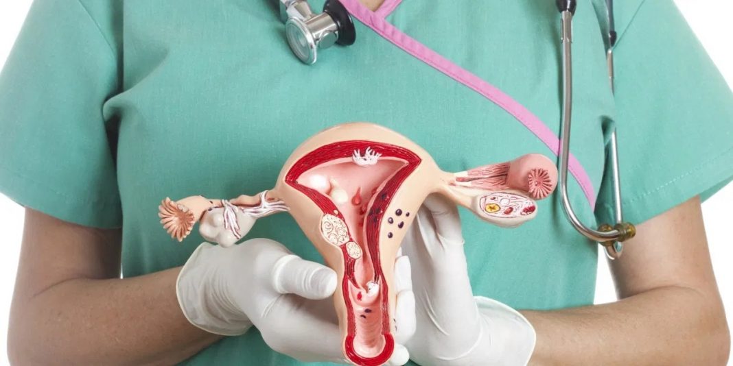 cáncer de cuello uterino