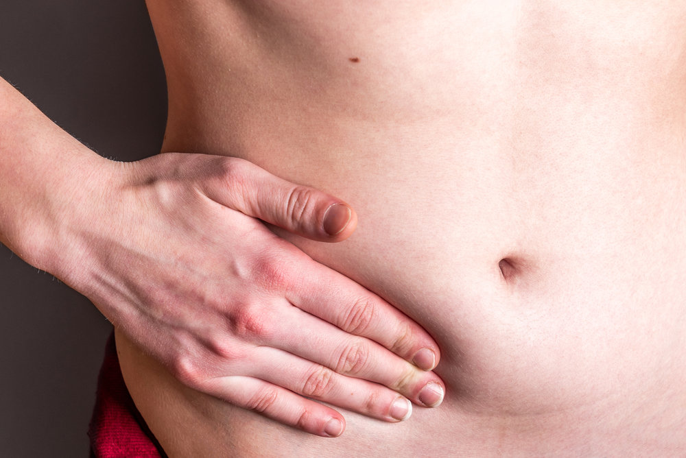 causa de las hernias