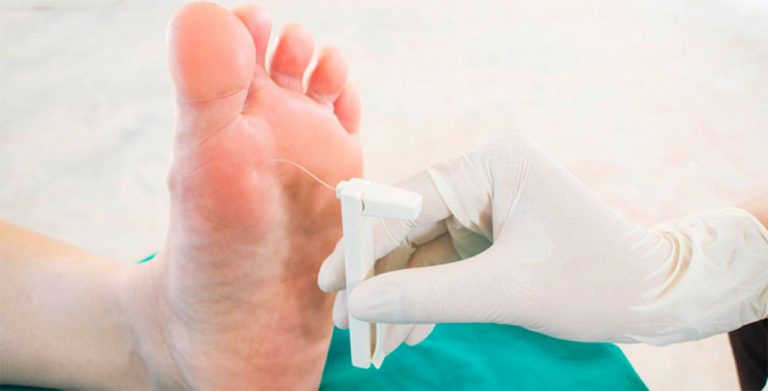 Tipos de neuropatía diabética