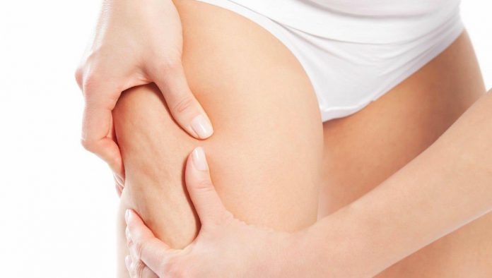 Hidratación celulitis
