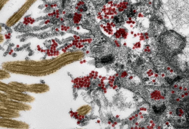 CEPA DEL CORONAVIRUS