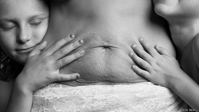 cuerpo cambia luego del parto