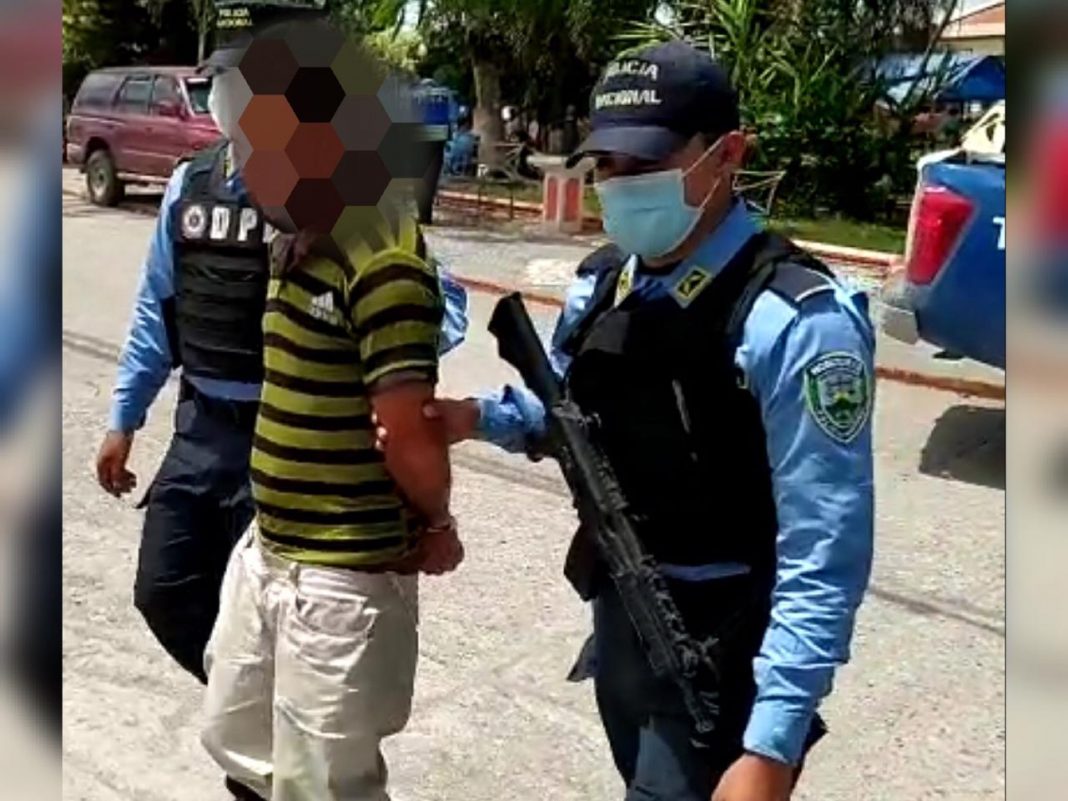 Hombre quema a pareja con agua caliente.