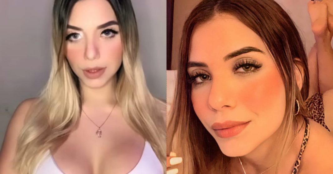 Jennifer Funes labios bótox