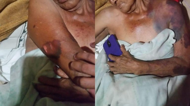 golpean señora Omoa