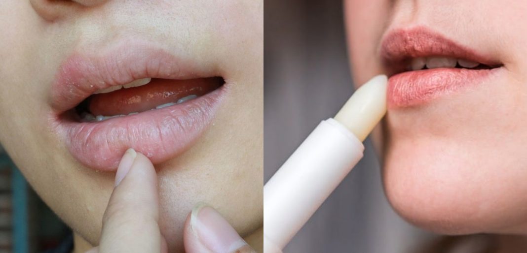 DE MUJERES| Cinco tips para combatir los labios resecos