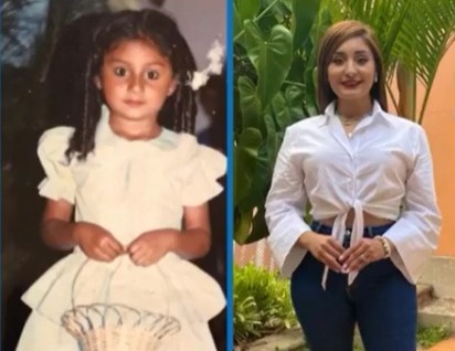 Comparación del antes y el después de Rina.