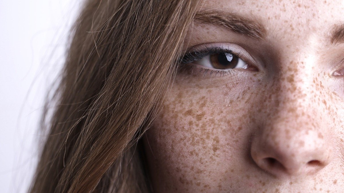 Algunas personas tienen más pecas que otras.