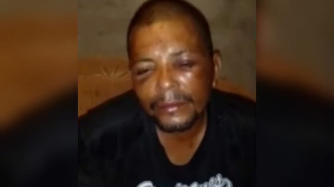 Olancho hombre golpeado