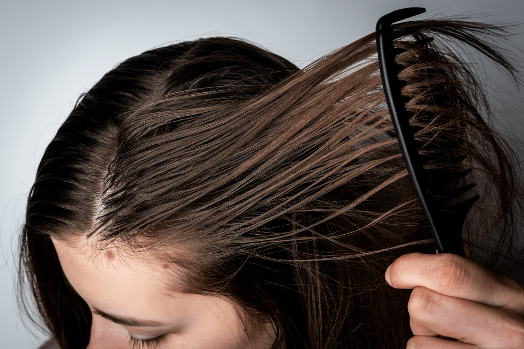 Remedios caseros para el cabello graso