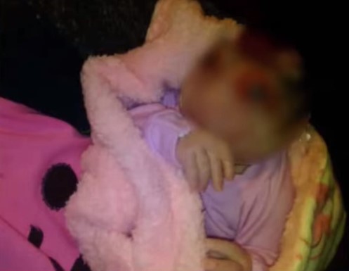 niña con rostro de pez Intibucá