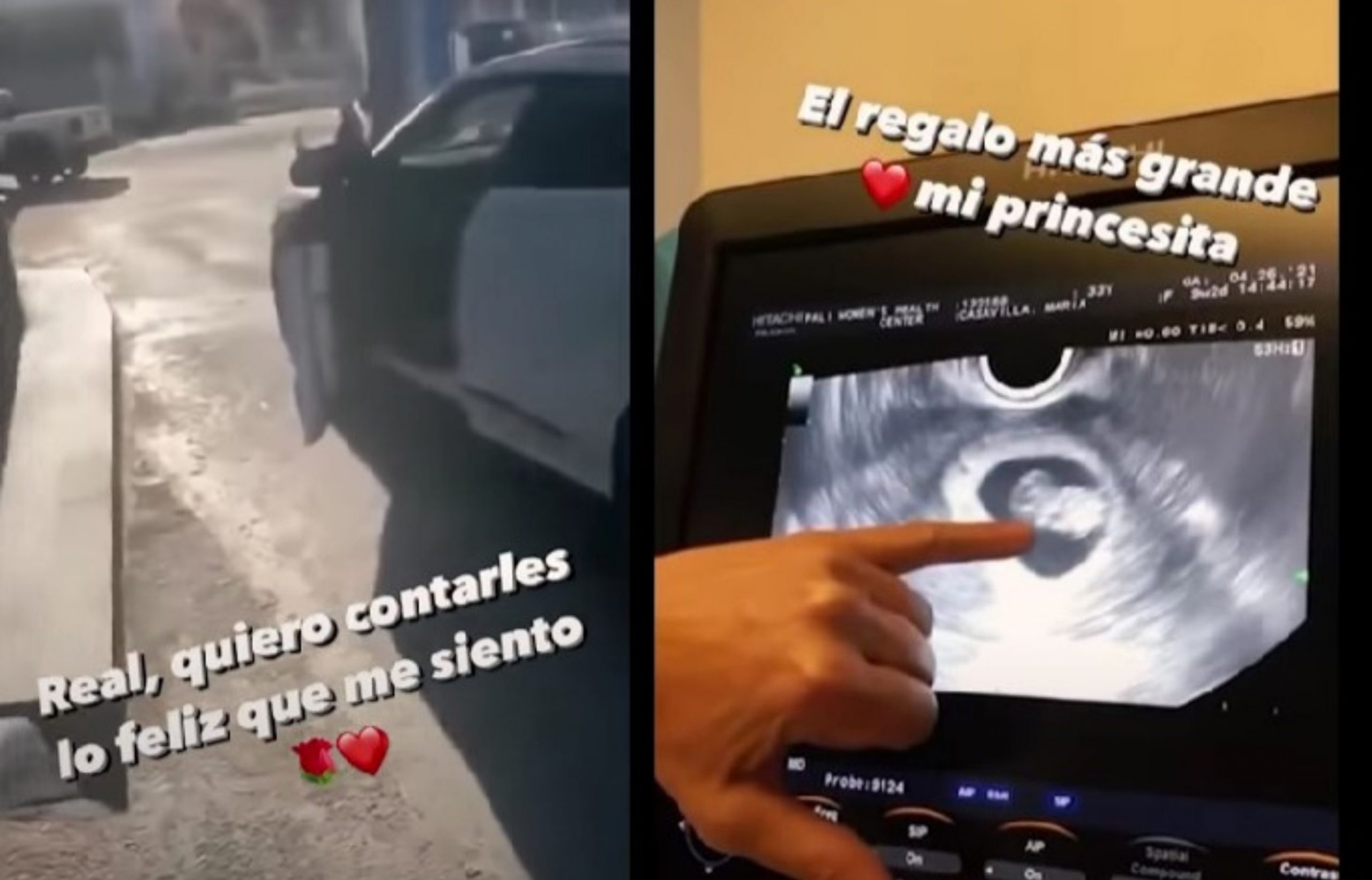 Karol G está embarazada