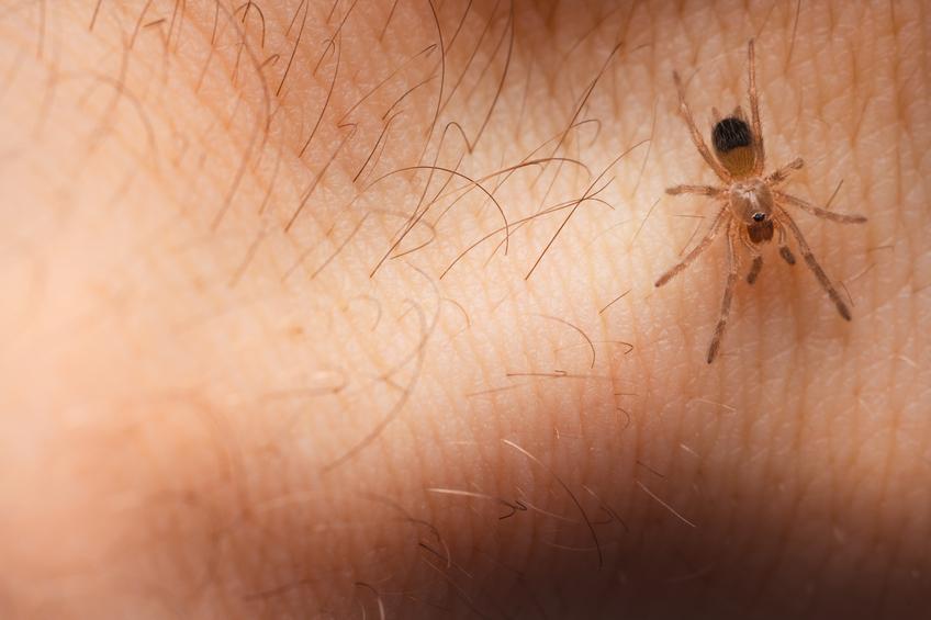 qué hacer si me pica una araña