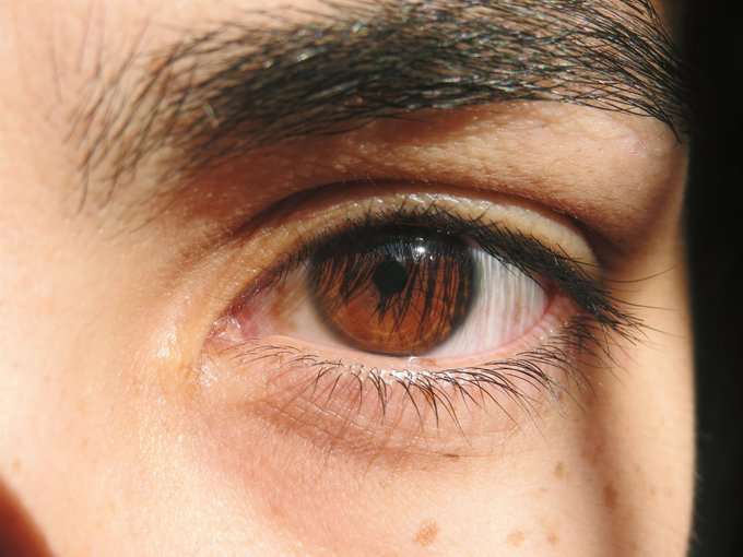 Ojos marrones y oscuros