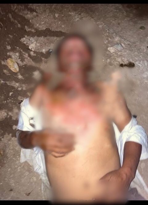 El hombre quedó con graves heridas en la parte de su rostro y parte de su pecho.