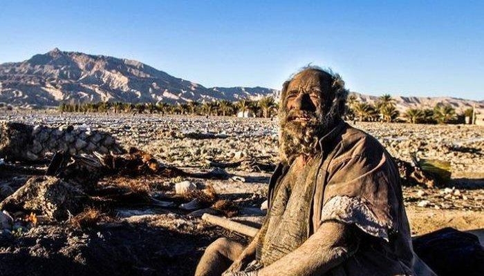 hombre con 70 años sin bañarse
