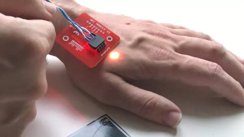 implantes de microchip