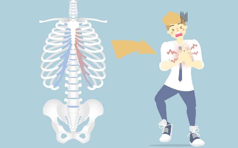 costocondritis confundido con infarto