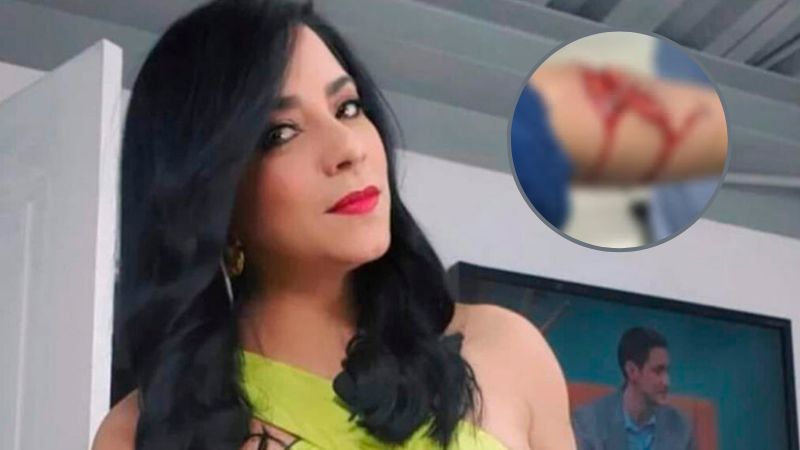 presentadora mordida por pitbull