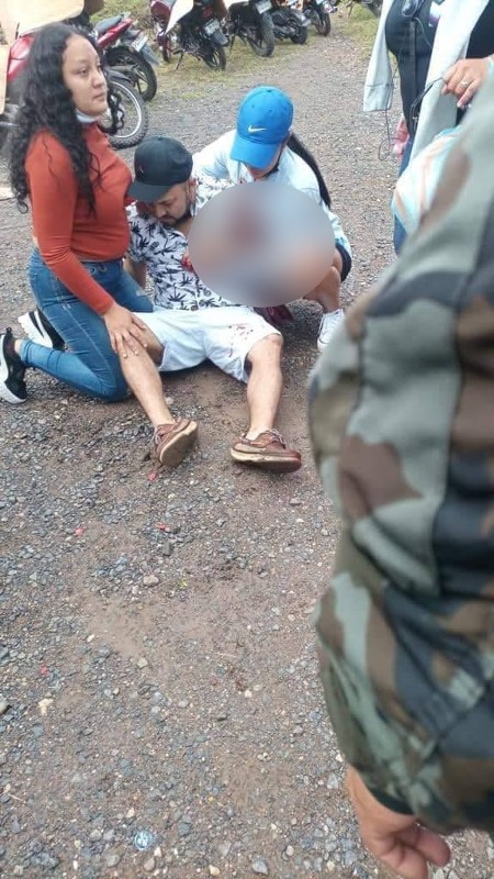 Hombre herido león perderá brazo