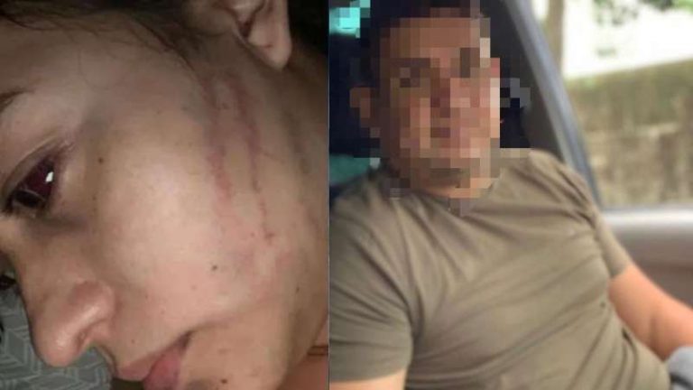Hondureña denuncia intento de asesinato