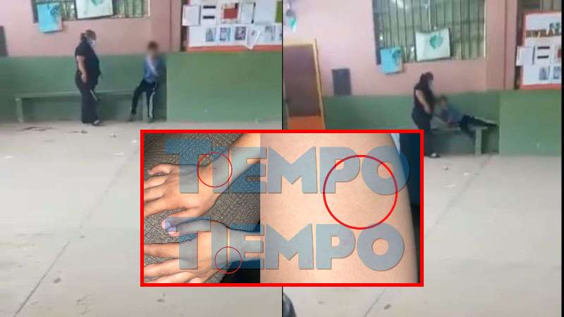 Madre de niño golpeado por maestra