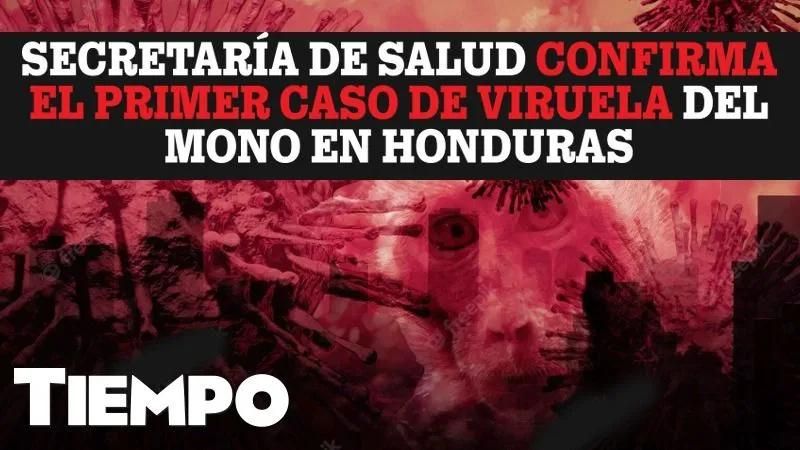 países con más casos de viruela del mono