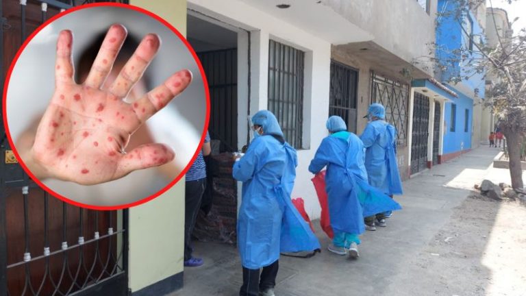 cerco epidemiológico viruela del mono
