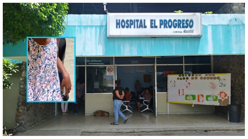 Madre quema a su hija en El Progreso