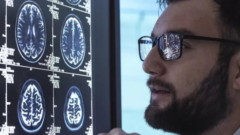 medicamento contra el Alzheimer