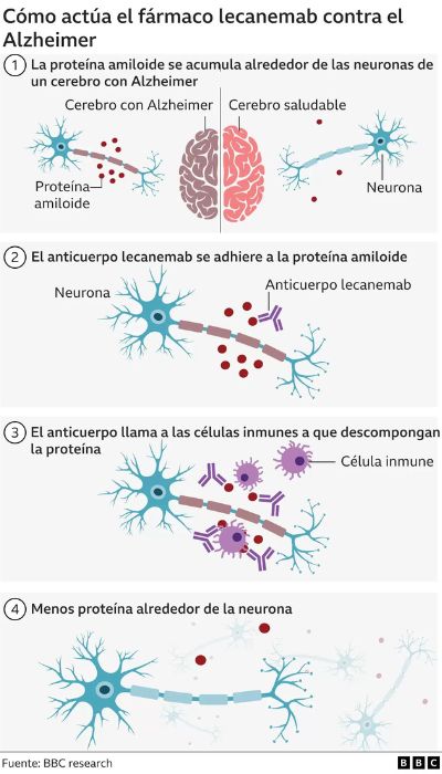 medicamento contra el Alzheimer