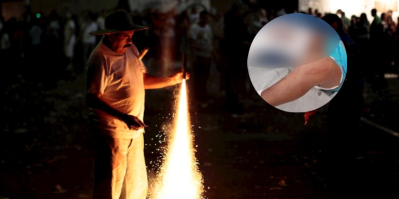 NIÑO QUEMADO CHOLUTECA (1)